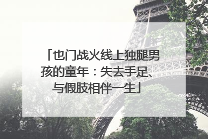 也门战火线上独腿男孩的童年：失去手足、与假肢相伴一生